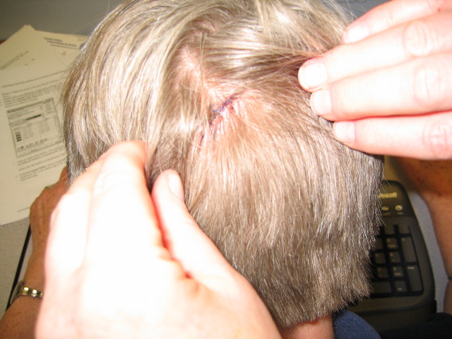 Yes, those are stitches!